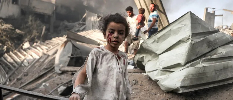 Severly shocked and injured Palestinian girl near rubble in Southern Gaza.